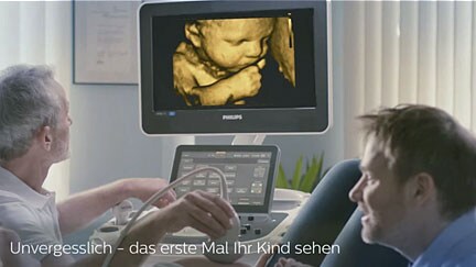 Video Philips Ultraschall