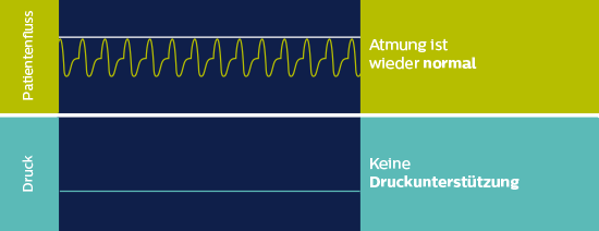 autoSV Algorithmus Unterstützung