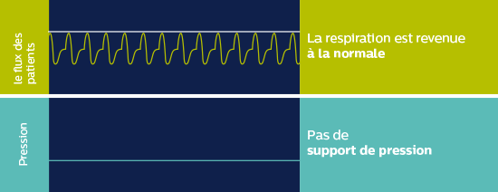 autoSV Aide plutôt que prise de contrôle