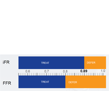 iFR® Studie