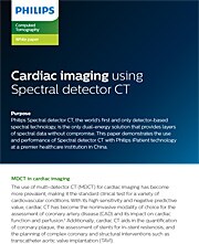 CT White Paper: Cardiac imaging using Spectral detector CT