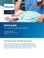 Quick Guide für Ultraschall (Download .pdf)