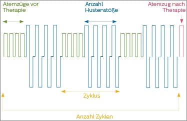 CoughAssist E70 Modus Erweitert Auto Diagramm