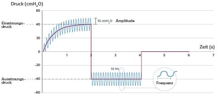 CoughAssist E70 Oszillation