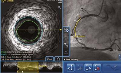 IVUS- und Physiologie-Workshop