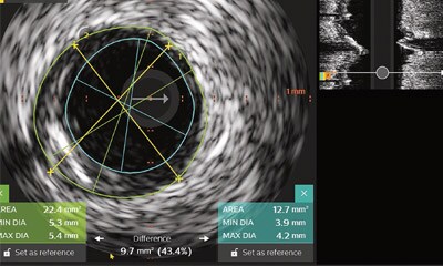 IVUS-Workshop