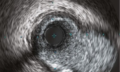 IVUS- und Physiologie Workshop