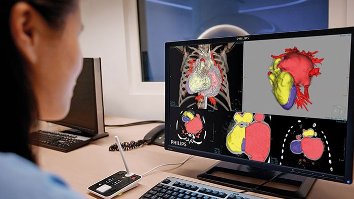Des cliniciens analysent les données patient à l’aide de la visualisation d’imagerie avancée