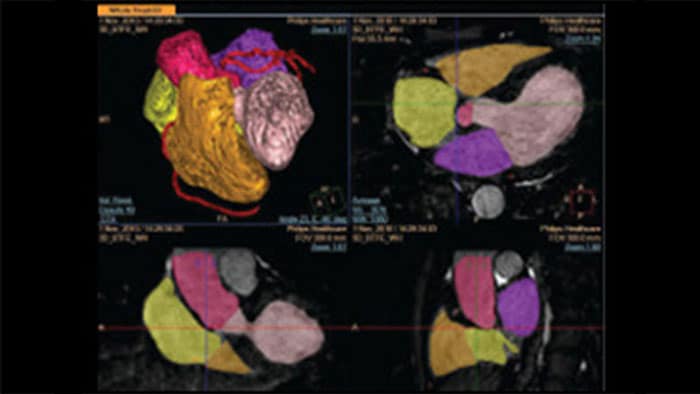 Images de scanner détaillées du cœur en 3D