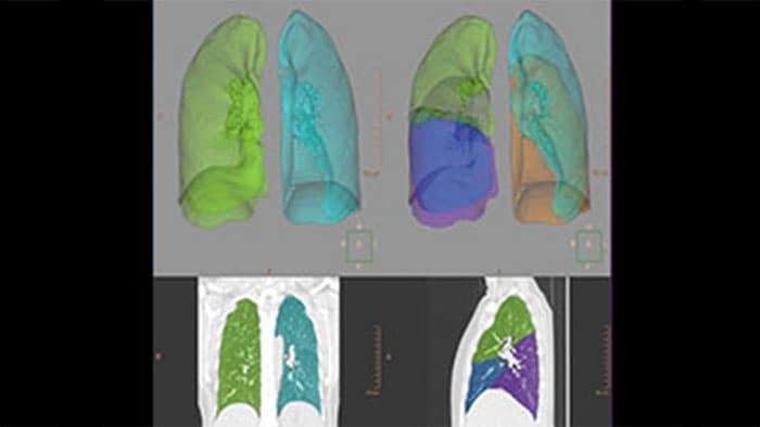 Images de scanner radiologiques de poumons humains