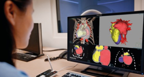 Analyse des données patient par les cliniciens dans la visualisation d’imagerie avancée