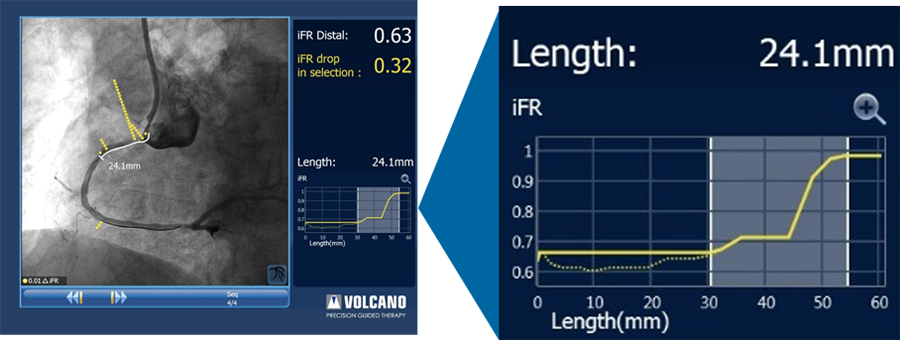 ifr co reg click and drag