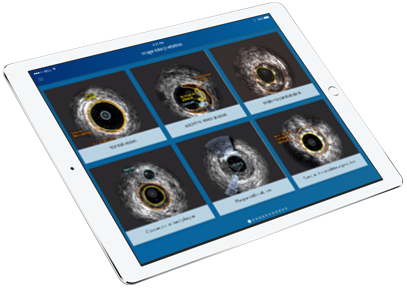 iPad IVUS-Experte