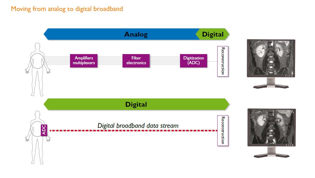 Umstellung von analogem auf digitales Breitbandschema