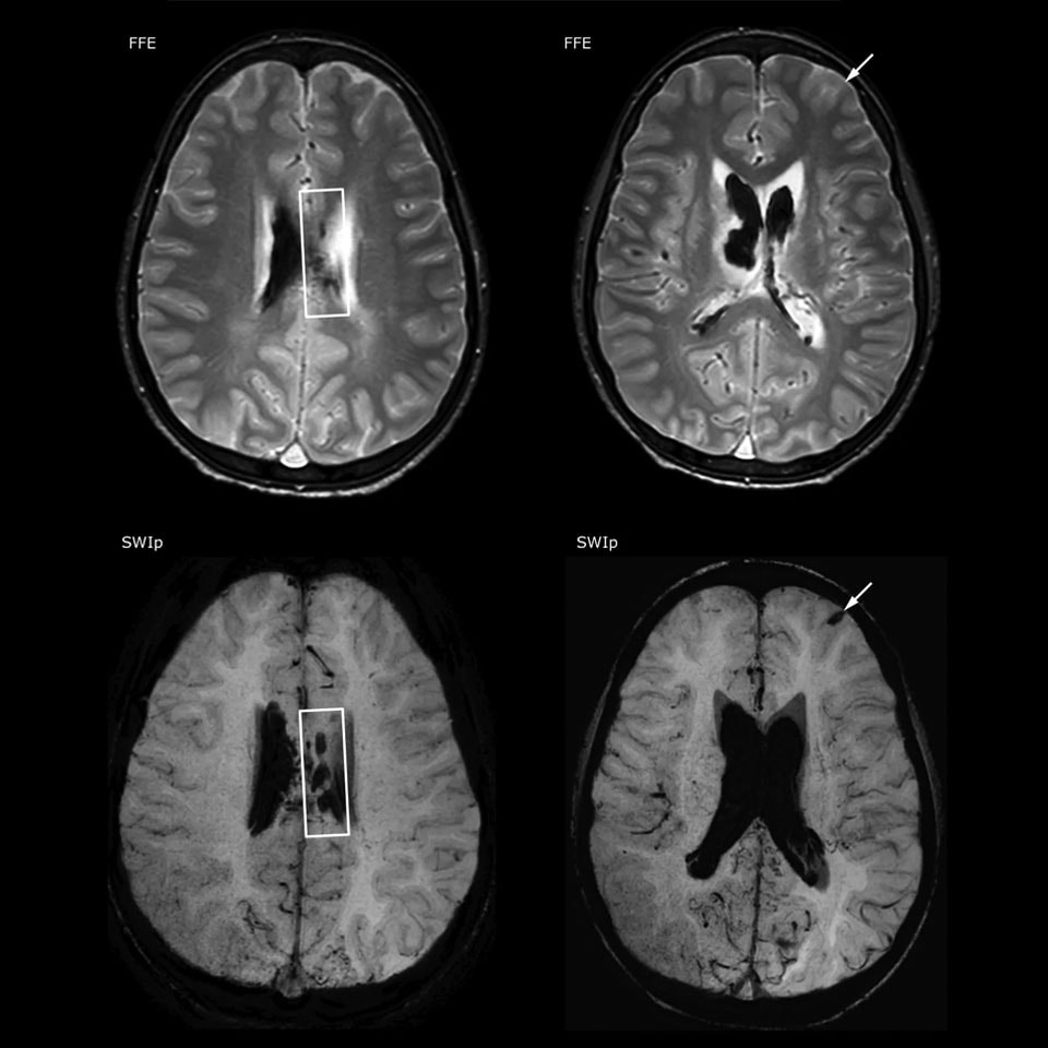 eine Nahaufnahme eines Gehirnscans