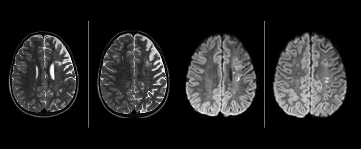 eine Nahaufnahme eines Gehirnscans