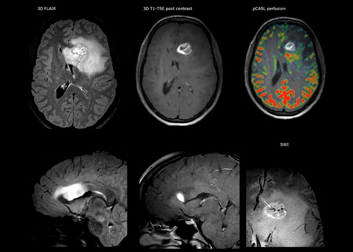 eine Nahaufnahme eines Gehirnscans