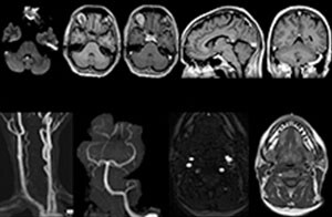 MR-Angiographie Kopf und Hals