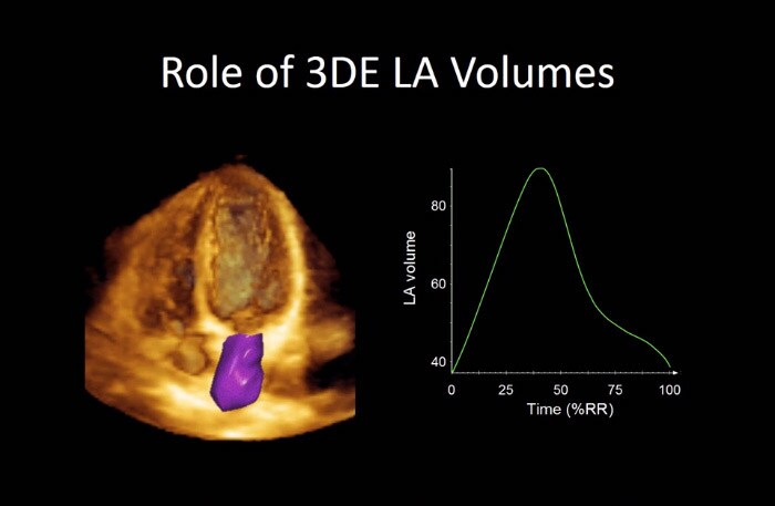 Rolle der 3D-LA-Volumen