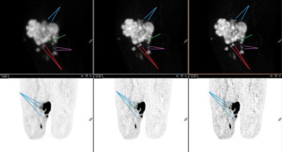Ganzkörper-Scans mit xFine und mit xSharp von Philips​