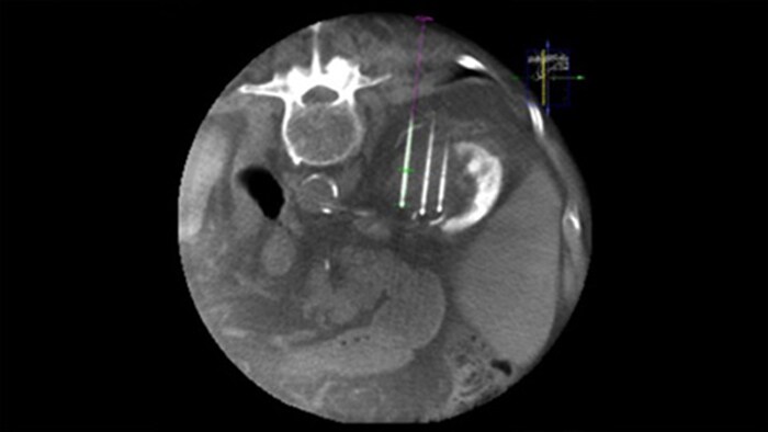 CBCT-3D-Bild, Dual View