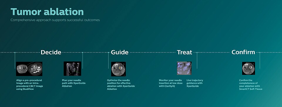 Infografik Tumorablation