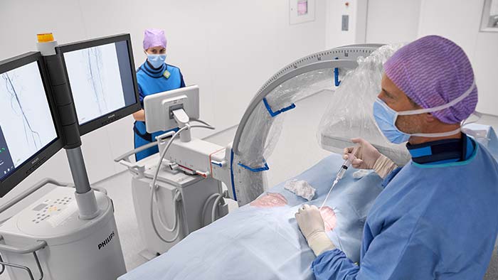 Mobile C-Bögen für die Gefässdiagnostik