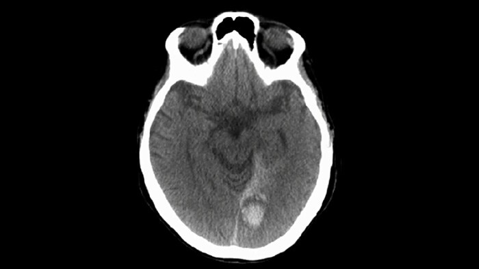 CBCT (CT-artig)