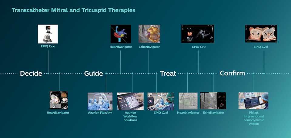 Transkatheter-Therapien der Mitral- und Trikuspidalklappe