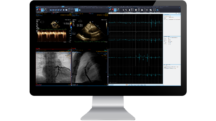 Benutzeroberfläche des Kardiologiemoduls auf einem Monitor