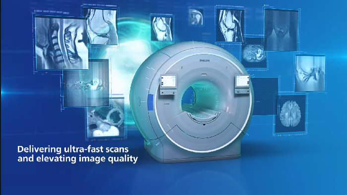 Philips SmartSpeed klinische MR-Applikation | Philips Healthcare