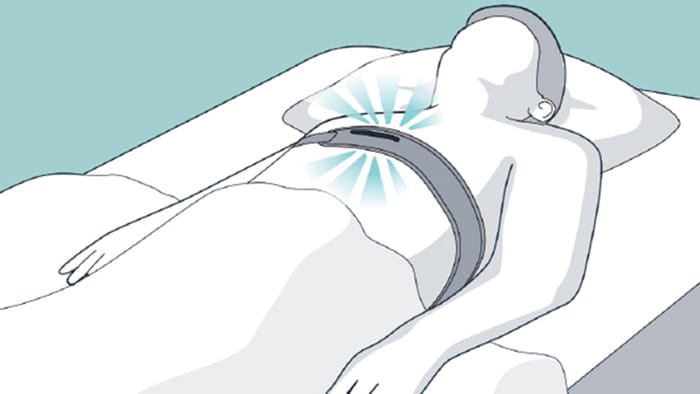 Abbildung eines Patienten in Rückenlage mit Philips NightBalance