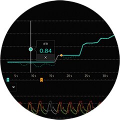 IntraSight iFR