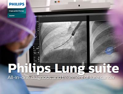 Lung Suite PDF