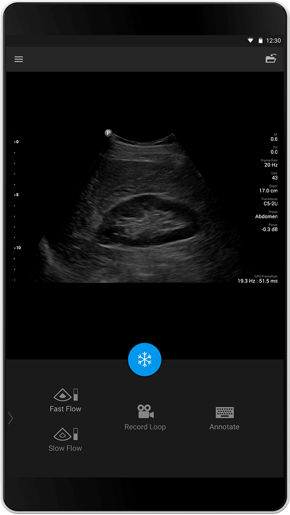 Abdomen-Untersuchung C5-2