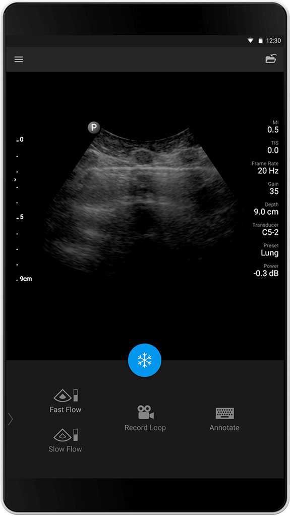 Examen pulmonaire C5-2