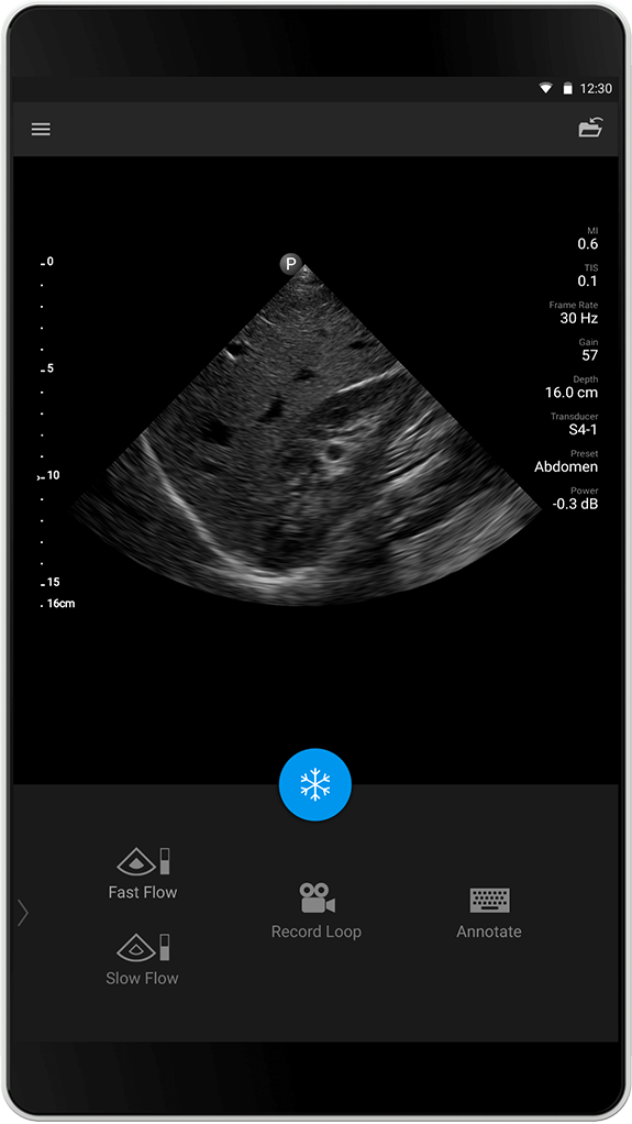 Abdomen-Untersuchung S4-1