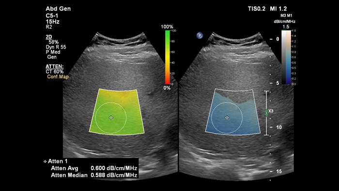 Sichere Attenuation