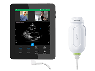 Epiq 7 ultrasound machine