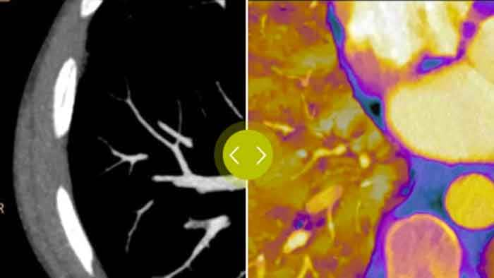 Scanner spectral IQon