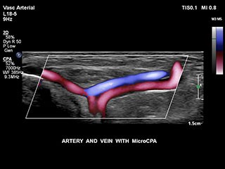 ARTERIEN_VENEN MIT MCPA