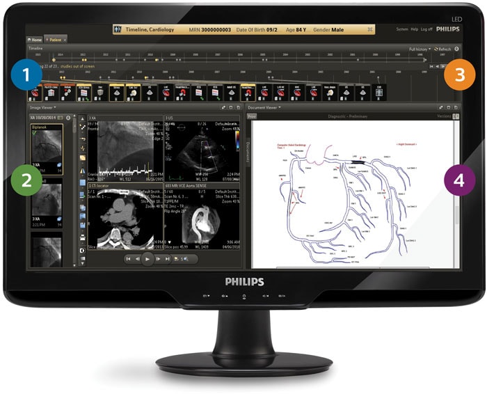 Ein Computermonitor mit einem Screenshot eines Herzscans