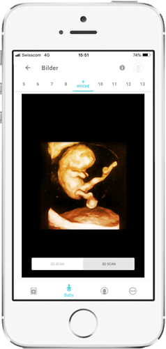 Schwangerschaft + Screenshots