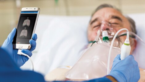 Philips und DiA Imaging Analysis: Partnerschaft für mehr KI in der Ultraschalldiagnostik