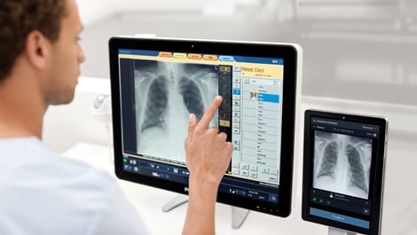 Philips Radiology Smart Assistant