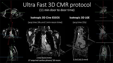 Philips und das Centro Nacional de Investigaciones Cardiovasculares Carlos III (CNIC) entwickeln neues, ultraschnelles Kardio-MRT-Protokoll