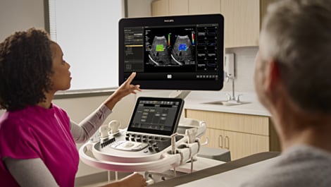 Philips Ultraschall mit automatisierten Workflows und quantitativen Messfunktionen