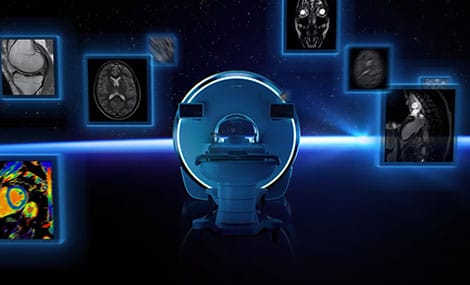 Philips Horizon: Technologischer Durchbruch mit erstem heliumfreien 3.0T MRT 