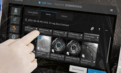 Weltpremiere bei der 92. DGK-Jahrestagung: Philips pr&auml;sentiert IntraSight Plus &ndash; eine Innovation, die Koronarinterventionen erleichtert und die Pr&auml;zisionsmedizin weiterentwickelt.